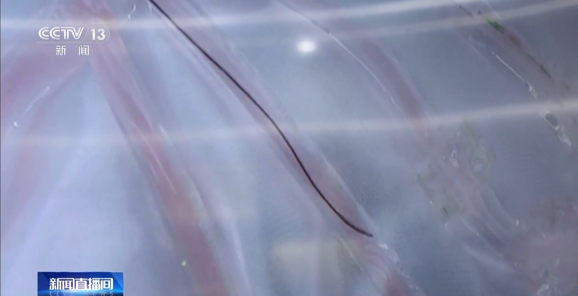 “超级助手”来帮忙AI让深圳医疗效率“起飞”(图2)