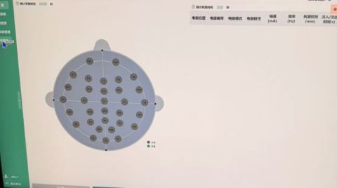 现在脑机接口的产品经理到底在做什么？