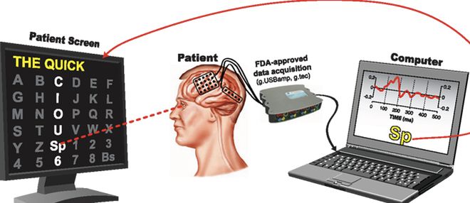 现在脑机接口的产品经理到底在做什么？(图7)